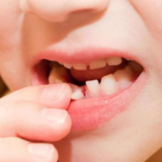 Nằm mơ thấy rụng răng mang lại con số gì may mắn 5 Giải mã chi tiết tình huống nằm mơ thấy rụng răng và ý nghĩa