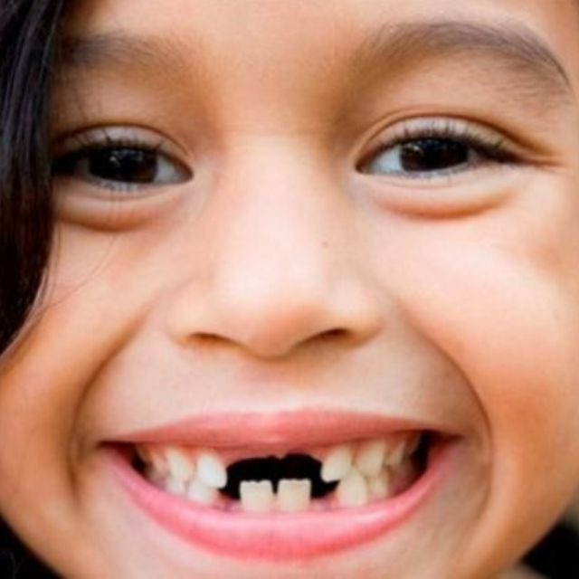 Nằm mơ thấy rụng răng mang lại con số gì may mắn 6 Nằm mơ thấy rụng răng mang lại con số gì may mắn